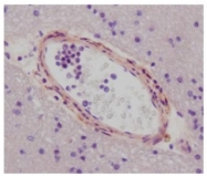 DP3521S - EGFL7