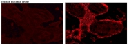 DM3524 - Placenta growth factor / PGF