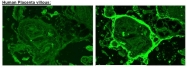 DM3524 - Placenta growth factor / PGF