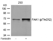 AP02438PU-S - PAK1