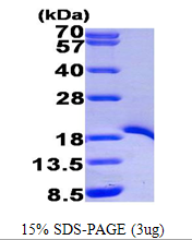 AR09508PU-L - TRAF1 / EBI6