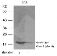 AP08007PU-N - Myosin light chain 2 (MYL2)