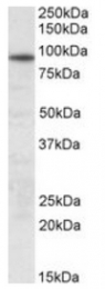 AP10403PU-N - UNC45B