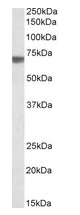 AP10415PU-N - TGFBI / BIGH3