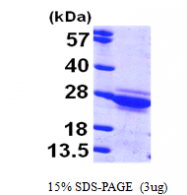 AR09529PU-L - Cytoglobin