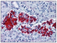 AM12136PU-N - G protein alpha inhibitor 1
