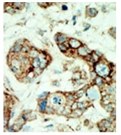 AP14274PU-N - EPHA2 / ECK