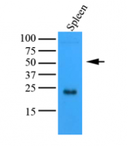 AM09363PU-N - TNF-beta / Lymphotoxin-alpha