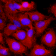 AM09363PU-N - TNF-beta / Lymphotoxin-alpha