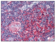 AP07548PU-N - Beta-2-microglobulin
