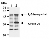AM20022AF-N - Cyclin D2