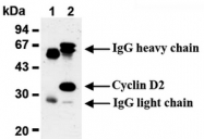 AM20023AF-N - Cyclin D2