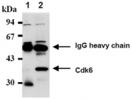 BM5021A - CDK6
