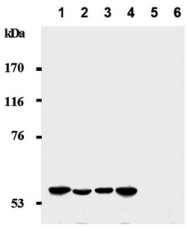 AM20030AF-N - CDKN1C / KIP2