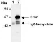 AM20032AF-N - CHK2