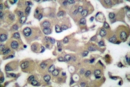 AP06184PU-N - Involucrin / IVL