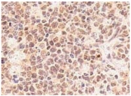 AM00404AF-N - TFDP1