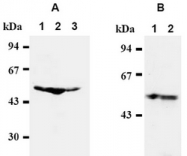 AM00404AF-N - TFDP1