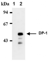AM00404AF-N - TFDP1
