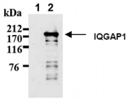 AM20036AF-N - IQGAP1