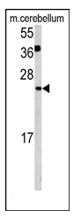 AP20046PU-N - Glutaredoxin-2 / GLRX2