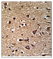 AP20046PU-N - Glutaredoxin-2 / GLRX2