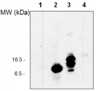 AP20051SU-N - Ubiquitin