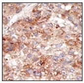 AP11229PU-N - Ubiquitin