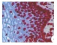 BM4502 - Lamin-B2 (LMNB2)