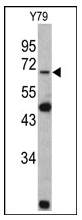 AP20053PU-N - Lamin-B2 (LMNB2)