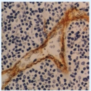 SM1201T - CD141 / THBD