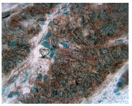 AM05195PU-N - CD56
