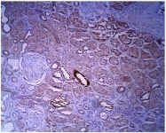AP05278PU-N - SGMS2