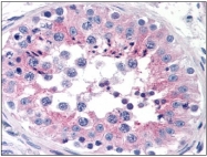 AM03078PU-N - Apolipoprotein J / Apo J