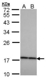 AP19052PU-N - Beta-crystallin A4