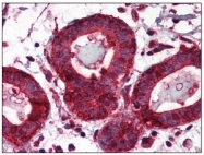 AM09037PU-N - Endoplasmin / HSP90B1 / TRA1