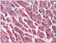 AM09037PU-N - Endoplasmin / HSP90B1 / TRA1