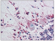 AM09003PU-N - Cathepsin D