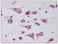 AM09003PU-N - Cathepsin D