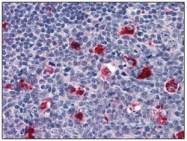 AM09003PU-N - Cathepsin D