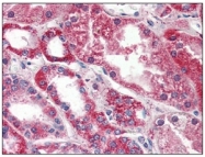 AM09015PU-N - Phosphoserine phosphatase