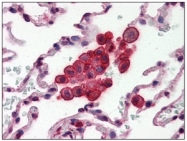 AM09004PU-N - Apolipoprotein J / Apo J