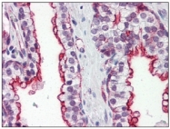 AM09004PU-N - Apolipoprotein J / Apo J