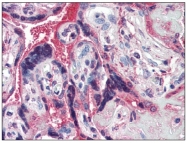 AM20107PU-N - Haptoglobin