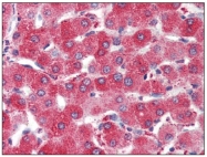 AM20107PU-N - Haptoglobin