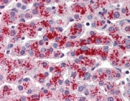 AM20108PU-N - Transthyretin / Prealbumin