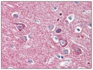 AM05641PU-N - Hexokinase