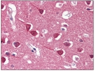 AM09032PU-N - REXO1