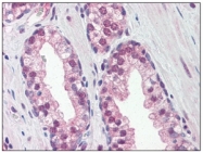AM09032PU-N - REXO1