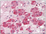 AM03116PU-N - CD73